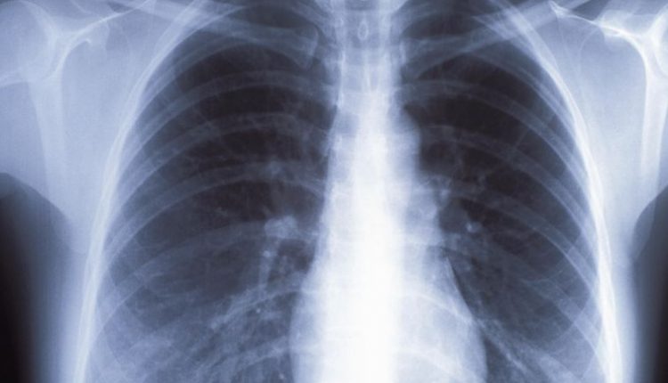 Hospital devices exposed to hacking with unsupported operating systems